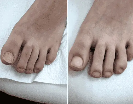 comment photo review